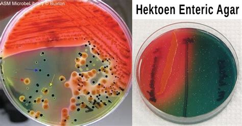 hektoen enteric agar.